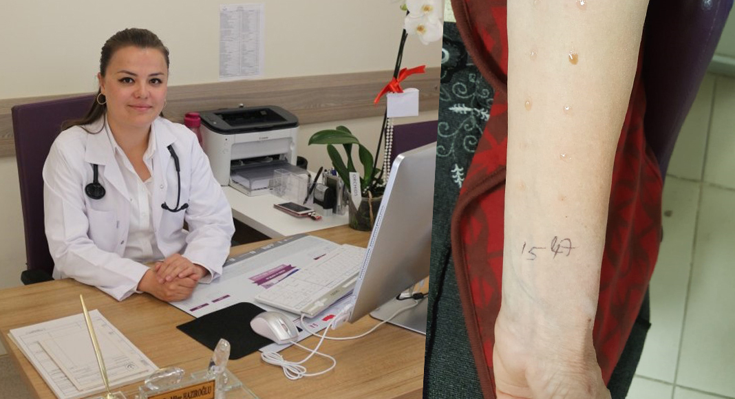 ÇİVRİL’DE DERİ TESTİ YAPILIYOR