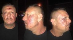 DENİZLİSPOR BAŞKANI TEDAVİ ALTINDA