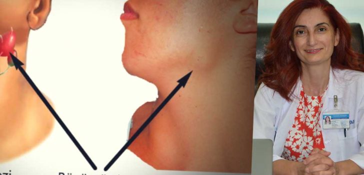 “LENFOMA FARKINDALIĞI HAYAT KURTARIR”