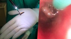 KARANFİL ÇİĞNERKEN BİR KEZ DAHA DİKKAT