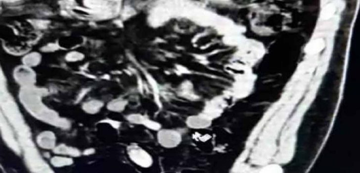 MİDELERİNDE 100 PAKET UYUŞTURUCU İLE OTOGARDA YAKALANDILAR