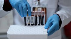 KAN STOKLARINDA CİDDİ AZALMA YAŞANIYOR