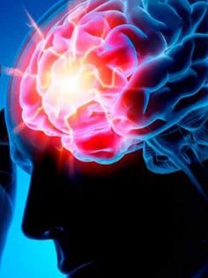 BEYİN BY PASS AMELİYATI FELÇTEN KURTARIYOR