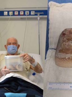 MESANEDEN ÇIKAN DEVASA TAŞLAR ŞAŞKINLIK YARATTI