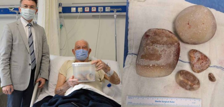 MESANEDEN ÇIKAN DEVASA TAŞLAR ŞAŞKINLIK YARATTI