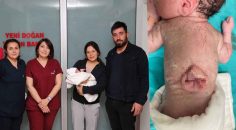 BAYRAM BEBEK HAYATA TUTUNDU