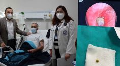 AKCİĞERİNDEN BEZELYE TANESİ ÇIKTI