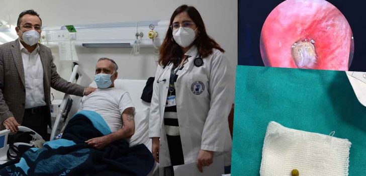 AKCİĞERİNDEN BEZELYE TANESİ ÇIKTI