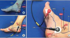 İDRAR KAÇIRMA TEDAVİSİNDE DÜNYA’DA BİR İLK