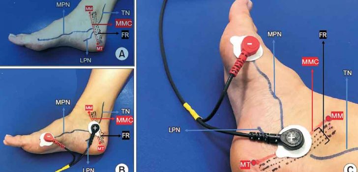 İDRAR KAÇIRMA TEDAVİSİNDE DÜNYA’DA BİR İLK