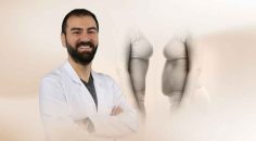 “LİPOSUCTİON DİYETE ALTERNATİF YÖNTEM DEĞİLDİR”