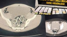 UYUŞTURUCUYU MAKATINA SAKLAMIŞ