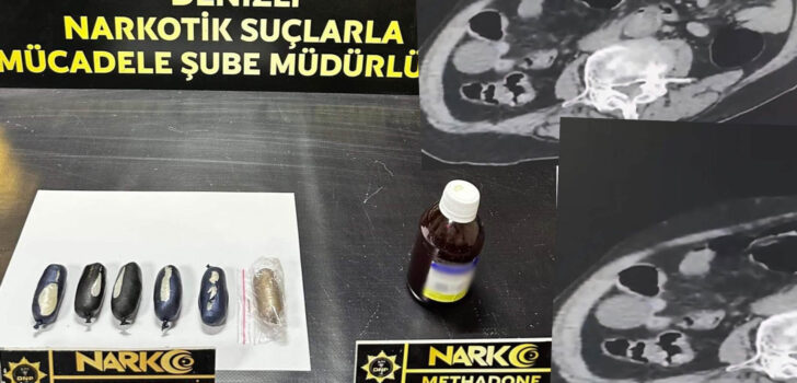 UYUŞTURUCUYU BEDENİNE SAKLAMIŞ