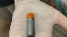 MİDESİNDEN PİL ÇIKTI