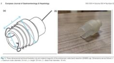 YENİ YÖNTEM ULUSLARARASI TIP CAMİASINDA KABUL GÖRDÜ