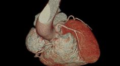 KALP HASTALIKLARINDA ERKEN TANININ ANAHTARI: KARDİYAK BT VE MR