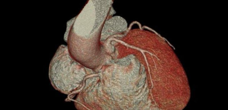 KALP HASTALIKLARINDA ERKEN TANININ ANAHTARI: KARDİYAK BT VE MR
